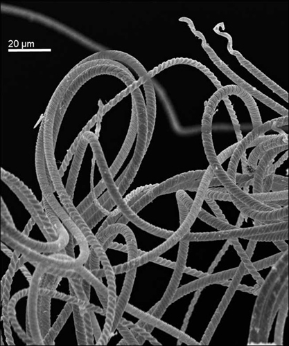 科学家发现一种远古生物巨大精子超过其身长 