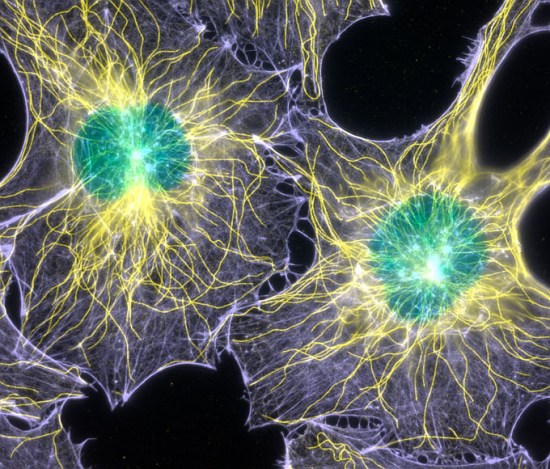 2003年最佳图片： 老鼠成纤维细胞的纤维肌蛋白和微管结构蛋白