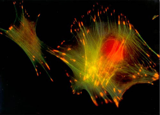 1997年最佳图片： 老鼠成纤维细胞