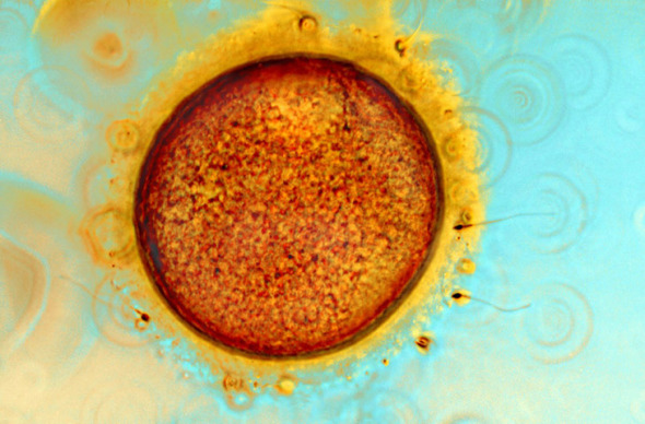 人类卵子和精子显微图