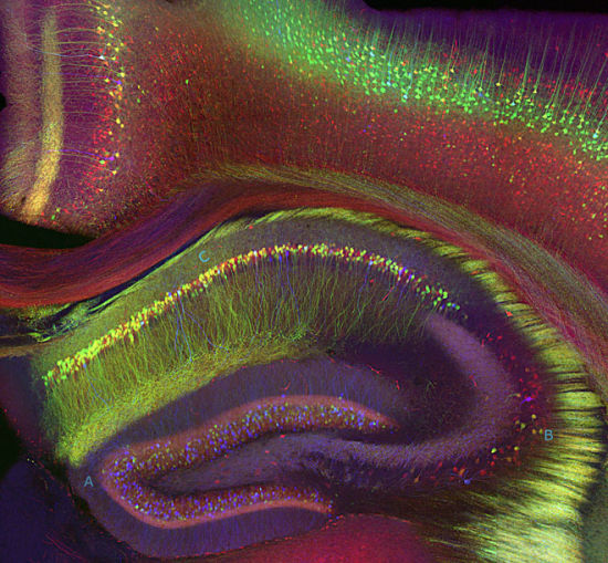 显微镜下的大脑：海马状突起负责认知与记忆(组图)