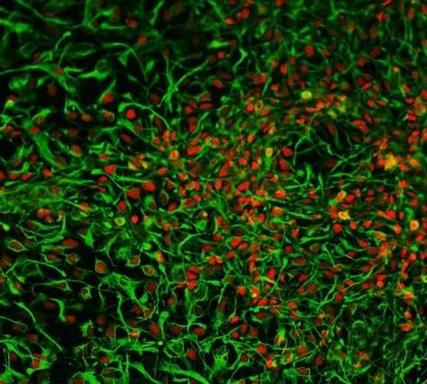 中国科学家利用尿液成功制造干细胞(图)细胞中国科学家