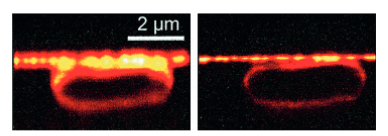 图3：第一张由斯特凡•W•黑尔（Stefan W. Hell）使用STED显微镜拍摄而成的图像。左边为使用传统显微镜拍摄的大肠杆菌，右边是使用STED显微镜拍摄的同样的大肠杆菌。STED图像的分辨率是前者的3倍