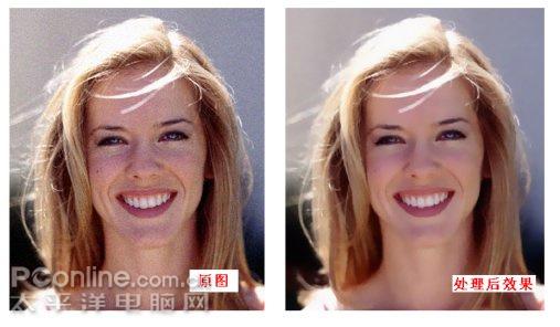 ƬͼҽImageDoctor