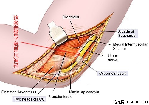 硬件 > 正文      人们对于肘管综合症的通俗叫法较多,常见的有"键盘