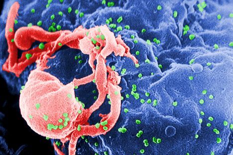 新艾滋疫苗可适应不断变异病毒:明年临床试验