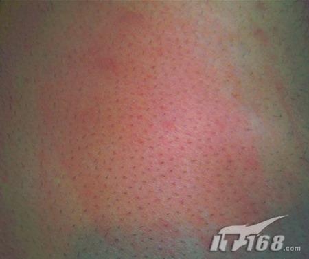 雪上加霜苹果iPhone3G再曝自燃事故