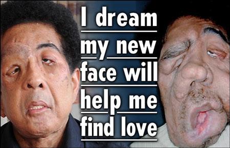 ���������˽�����������ȫ����ֲ������(ͼ)