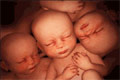  Images of triplets in the womb