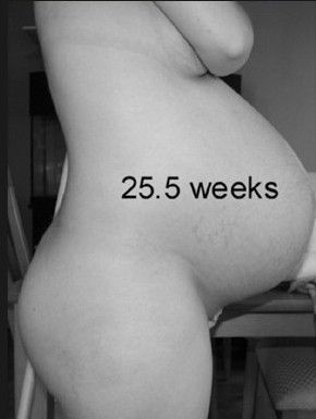 怀孕25周时