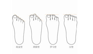 　图2-1 常见的四种脚型