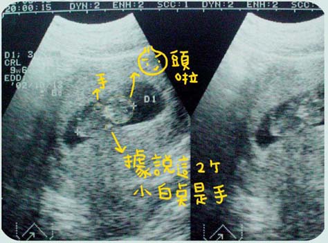 来看看我们的2人+1人世界(图)