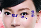 ࿴鼸