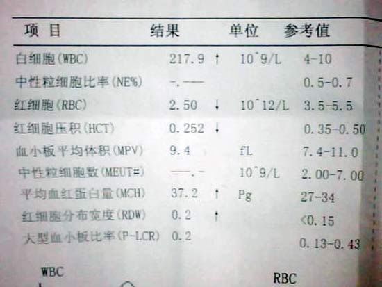 读懂血常规报告单,孩子疾病早知道(图)