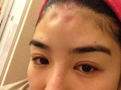 黄奕打玻尿酸伪造家暴