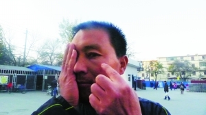 面部受伤的马先生。本报记者 裴强 摄 面部受伤的马先生。本报记者 裴强 摄