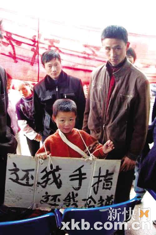 昆明十龄童堵医院讨手指