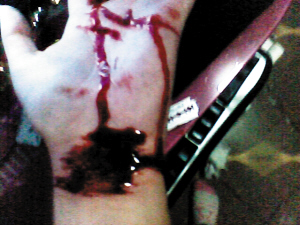 新自残照片赫然