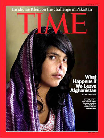 阿富汗少妇遭残忍割鼻政府或牺牲女性选择“和平”
