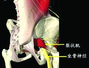 坐骨神经与梨状肌的关系模式图