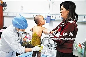 三龄童掉入开水锅奶奶自责欲轻生