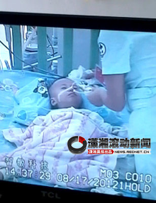 2岁邵阳宝宝患手足口病全家举债 帮忙请拨963