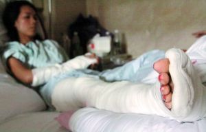国内新闻 > 正文 女子右腿受伤严重,现在已经打上石膏.