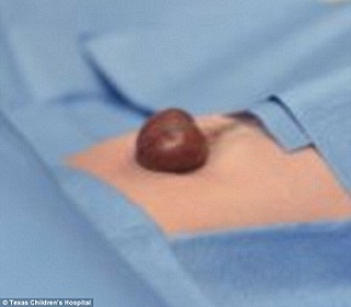 ŮӤ���೤������ҽ���ɹ�����������Ż�(ͼ)