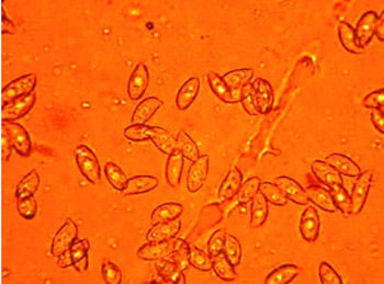 显微镜下一些真菌孢子的照片. (资料图片)