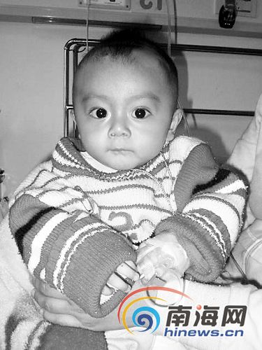 三亚无肛儿靠肚皮排泄 生命危在旦夕[图]