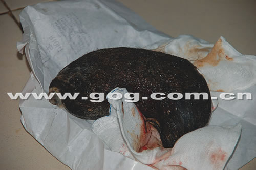 开胃取出<em>头发</em>近一斤_新闻中心_新浪网