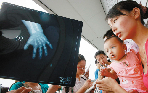 北京确诊一例婴儿性早熟