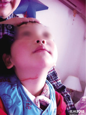 �����ķ����߼�����˲��ѹǿ��̹������