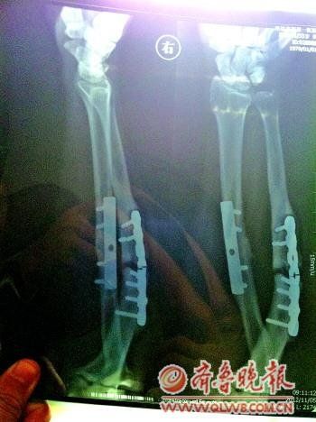 ��������ְ��������15��Ԫ���Ժ��Ը������