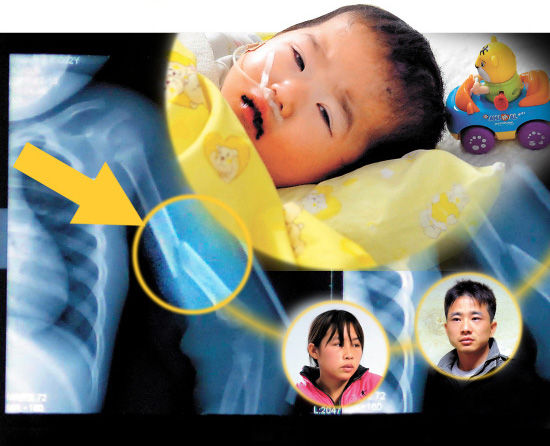 广东两岁女童被虐重伤<em>外阴</em>撕裂 父亲继母成疑