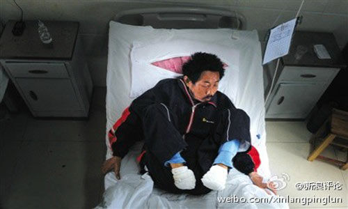 “自断双脚”悲剧，患者刘敦和身边的亲友、邻里对他疏于关心，显然应排在最前头。