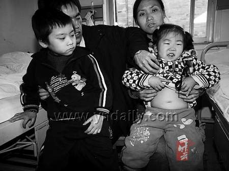可怜宣威小兄妹双双患上肾病,小女孩肚子胀大,眼睛肿得成了一条缝.