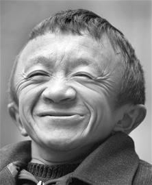 袖珍夫妻结婚半年后闹离婚:邻居称两人关系不好
