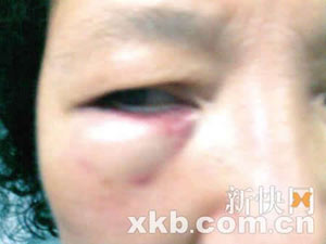 深圳公务员无故暴打女邻居被拘留(图)