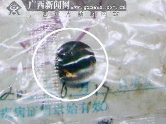 3岁幼女被摧残下体藏异物 取出后竟是电池已生