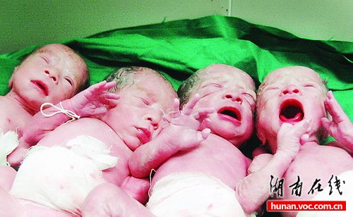 24岁孕妇自然怀孕四胞胎顺利生产(图)