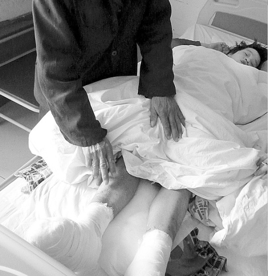 女子遭公婆与丈夫联手虐待嘴唇被拧脚趾变黑