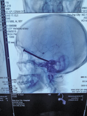 CT��ʾ�����������������Ϸ������������ԡ�