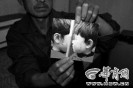 Ů����ͬѧץ�� ��������׶����ҽ��Է�ץ��