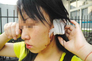 男子对女子提非分要求遭拒后咬掉对方耳朵