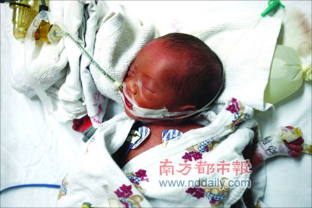 孕妇一分钟内顺产三胞胎(组图)