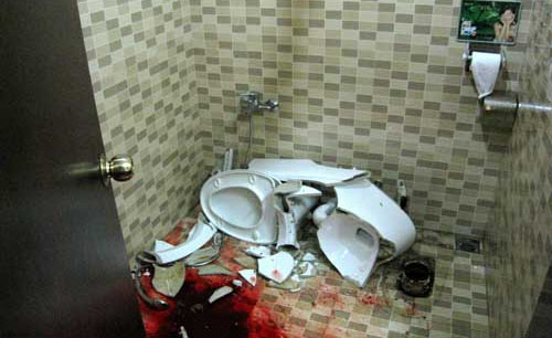 顾客在宾馆如厕时被马桶割伤30厘米(组图)