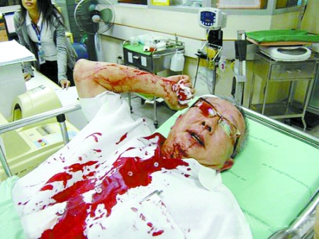 泰民盟领导人颂提遭枪击受伤