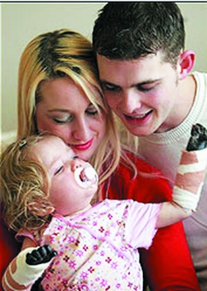 4岁无手女孩当童模