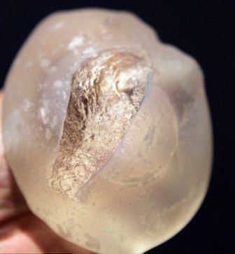 法国整形业丑闻升级 男性隆胸及睾丸假体也用